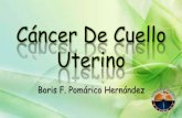 Cáncer de cuello uterino BORIS POMÁRICO HERNÁNDEZ