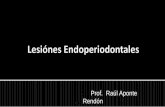 Endoperio. Lesiones Endoperiodontales.