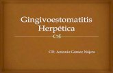 Gingivoestomatitis herpética1