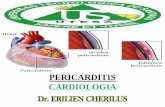 Pericarditis - Cardiologia