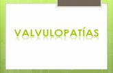 Valvulopatías - Diagnóstico por imágenes