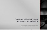 Enfermedad Vascular Cerebral Isquémica