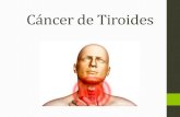 Tema 8 cancer de tiroides
