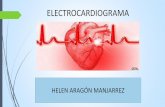 Electrocardiograma Reconocimiento de ritmos cardiacos