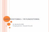 Gastrostomia y yeyunostomia