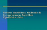 Eritema multiforme   stevens johnson - necrolisis epidermica toxica