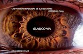 Glaucoma presentación