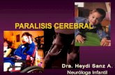 Paralisis cerebral conceptos generales