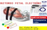 Monitoreo Fetal Electronico.
