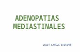 Adenopatias mediastinales