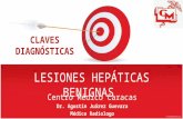 Lesiones hepáticas benignas