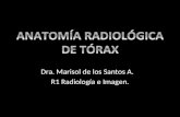 Anatomía radiológica de tórax