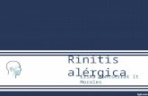 Rinitis alérgica
