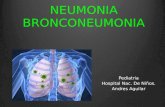 Bronconeumonia y neumonía  en Pxs pediatricos