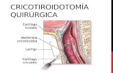 Cricotiroidotomía quirúrgica
