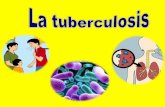 La tuberculosis