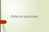 Defectos posturales