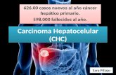 Carcinoma hepa tocelular