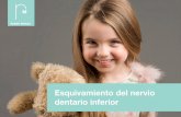 Case study 10_esquivamiento del nervio dentario inferior