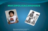 Mucopolisacaridosis presentacion final
