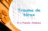 Trauma tórax