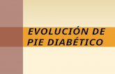 Evolución de pie diabético
