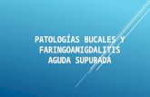 Patologías bucales y faringoamigdalitis aguda supurada. Rodrigo Fonseca. Dr. Guillermo Fonseca