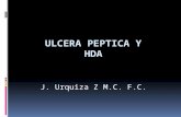 Ulcera peptica hemorragia digestiva (1)