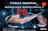 Radiograf­a de T³rax - Semiolog­a Radiol³gica