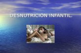 Desnutrici³n infantil2