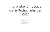 Interpretación Básica de La Radiografía de Tórax