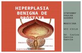 Hiperplasia benigna de próstata.pptx