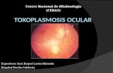 Toxoplasmosis Ocular