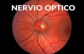 Nervio optico