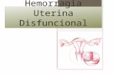 Hemorragia Uterina Disfuncional