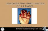 Conf. Lesiones Mas Frec. de La Mano