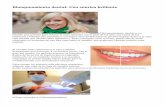Blanqueamiento dental: Una sonrisa brillante