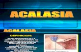 Clase Acalasia