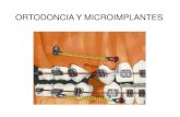 1) Ortodoncia y Microimplantes Imagenes