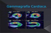 Gammagrafía tiroidea POWER POINT