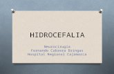 Hidrocefalia Clase 2011