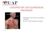 Lesiones Glandulas Salivales Dr Felipe