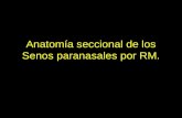 5.4 Anatomía seccional de los Senos paranasales por RM