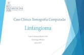Linfangioma TC - Gina Rocha