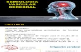 Semiologia Vascular Cerebral.