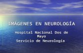 Imágenes en Neurología