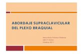 Abordaje supraclavicular del plexo braquialx.pdf