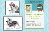 Hueso Lagrimal y Cornete Inferior
