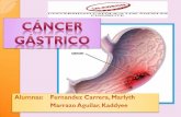 PAE Cancer Gastrico