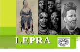 historia natural de lepra